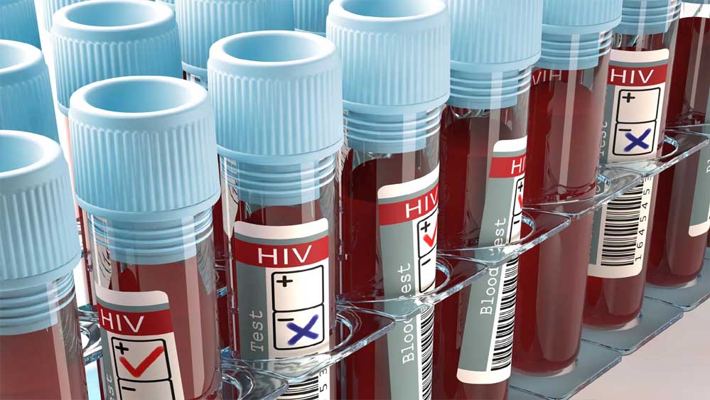 डराने वाले आंकड़े: MP में HIV संक्रमण तेजी से बढ़ा, मां से बच्चों तक पहुंच रहा खतरा