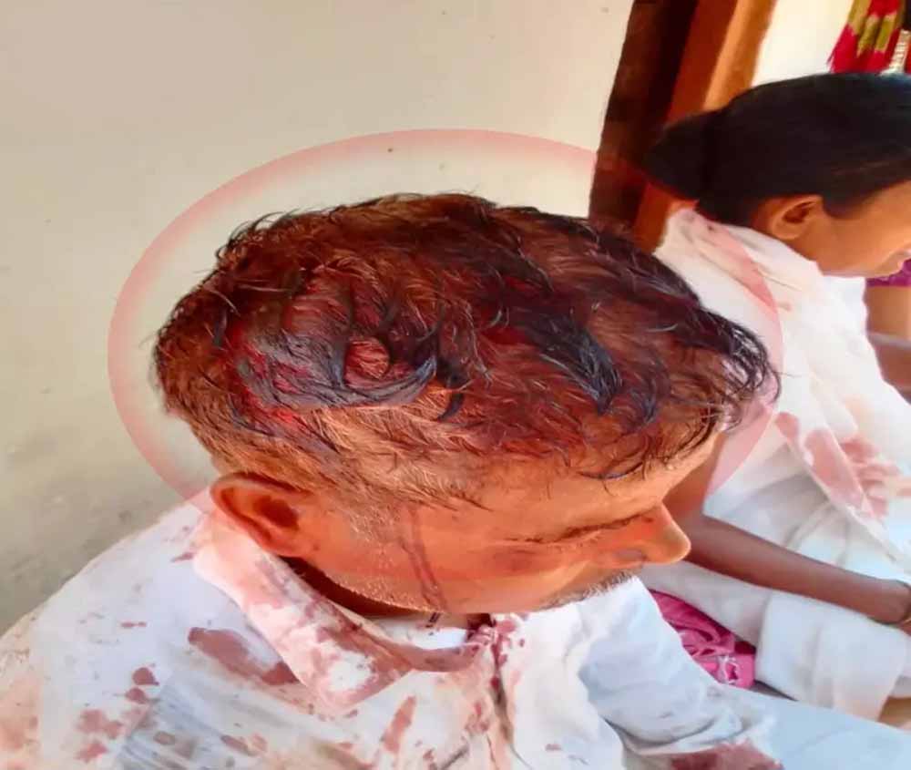 सुकमा: प्रार्थना सभा के दौरान भड़का विवाद, दो गुटों की हिंसक झड़प में कई घायल