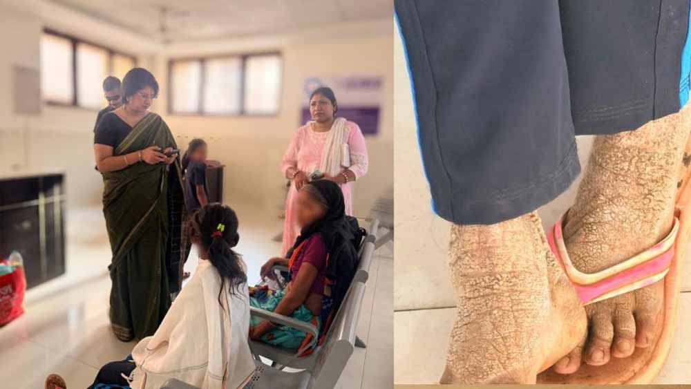 वर्णिका शर्मा ने एम्स रायपुर पहुंचकर जाना बालिका का हाल, उपचार प्रक्रिया हुई शुरू