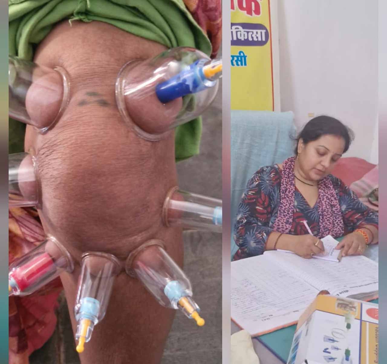 लोहरसी आयुर्वेदिक औषधालय में दर्द प्रबंधन हेतु कपिंग थेरेपी एवं विशेष आयुर्वेदिक उपचार सेवाओं का आर